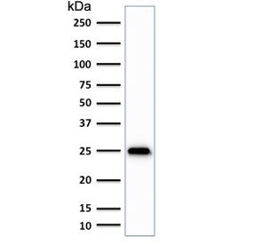 Western blot testing of human brain lysate with anti-UchL1 antibody (clone SPM575). Predicted molecular weight ~25 kDa.~