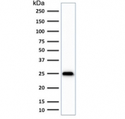 Western blot testing of human brain lysate with anti-UchL1 antibody (clone SPM575). Predicted molecular weight ~25 kDa.