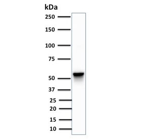 Western blot testing of Vimentin antibody (clone SPM576) and human A375 cell lysate. Predicted molecular weight ~58 kDa.
