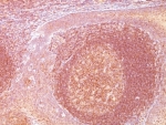 IHC: Formalin-fixed, paraffin-embedded human tonsil stained with Bcl10 antibody (SPM520).