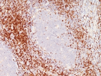 IHC: Formalin-fixed, paraffin-embedded human tonsil stained with anti-CD6 antibody (clone SPM547).~