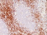 IHC: Formalin-fixed, paraffin-embedded human tonsil stained with anti-CD6 antibody (clone SPM547).