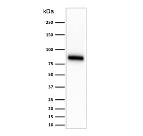 Western blot testing of human HeLa cell lysate with anti-CD44 antibody (clone SPM544). Predicted molecular weight ~81 kDa.~