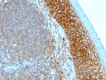 IHC: Formalin-fixed, paraffin-embedded human tonsil stained with anti-CD44 antibody (clone SPM544).