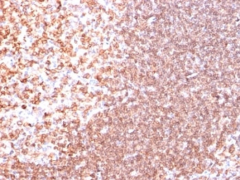 IHC analysis of formalin-fixed, paraffin-embedded human tonsil stained with anti-CD74 antibody (clone SPM523).