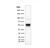 Western blot testing of human Raji cell lysate with CD79 antibody (clone SPM549). Expected molecular weight: 25-47 kDa depending on glycosylation level.