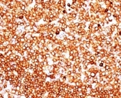 IHC: Formalin-fixed, paraffin-embedded human tonsil stained with CD79 antibody (clone SPM549).
