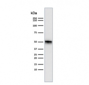 Western blot testing of human Raji cell lysate with CD79 antibody (clone SPM550). Expected molecular weight: 25-47 kDa depending on glycosylation level.