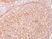 IHC: Formalin-fixed, paraffin-embedded human tonsil stained with anti-CD79a antibody (clone SPM550).