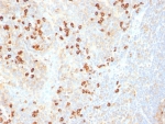 IHC: Formalin-fixed, paraffin-embedded human tonsil stained with Plasma cell Marker antibody (SPM310).