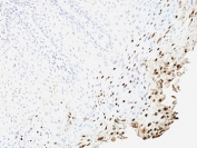 IHC: Formalin-fixed, paraffin-embedded human cervix stained with anti-L1 antibody (SPM257).