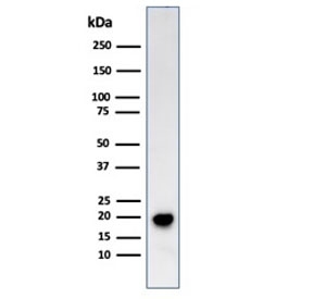 Western blot testing of human COLO-38 cell lysate with Melan-A antibody (clone SPM555). Expected molecular weight ~20 kDa with possible doublet.~