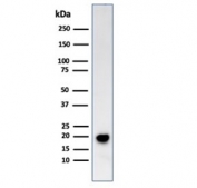 Western blot testing of human COLO-38 cell lysate with Melan-A antibody (clone SPM555). Expected molecular weight ~20 kDa with possible doublet.