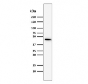 Western blot testing of human MCF7 cells with Cytokeratin 19 antibody (clone SPM561). Predicted molecular weight ~43 kDa.