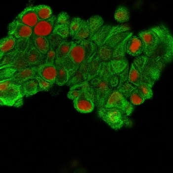 Immunofluorescent staining of MeOH fixed human MCF7 cells with Cytokeratin 19 antibody (clone SPM561, green) and Reddot nuclear stain (red).