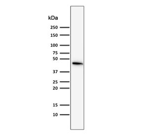 Western blot testing of human MCF7 cells with Cytokeratin 19 antibody (clone SPM561). Predicted molecular weight ~43 kDa.