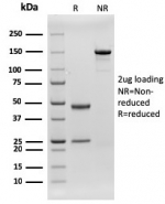 SDS-PAGE analysis of purified, BSA-free recombinant CD79b antibody (rIGB/1842) as confirmation of integrity and purity.