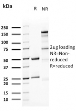 SDS-PAGE analysis of purified, BSA-free UPK1A antibody (clone UPK1A/2923) as confirmation of integrity and purity.