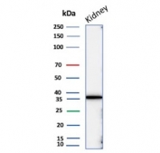 IHC staining of FFPE human lung tissue with recombinant Napsin A antibody (clone NAPSA/7043R). Negative control inset: PBS instead of primary antibody to control for secondary binding. HIER: boil tissue sections in pH 9 10mM Tris with 1mM EDTA for 20 min and allow to cool before testing.