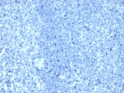 Negative control: IHC staining of FFPE human tonsil tissue with recombinant ErbB2 antibody (ERBB2/4376R) at 2ug/ml in PBS for 30min RT. HIER: boil tissue sections in pH 9 10mM Tris with 1mM EDTA for 20 min and allow to cool before testing.