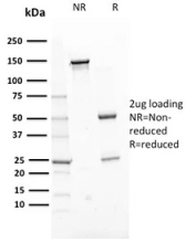 ERCC1 Antibody SDS-PAGE Purity Analysis. SDS-PAGE analysis of purified ERCC1 Antibody (mouse monoclonal, clone ERCC1/2318) under non-reducing (NR) and reducing (R) conditions demonstrates bands corresponding to intact antibody (~150 kDa) in NR lanes and heavy (~50 kDa) and light (~25 kDa) chains in R lanes, confirming antibody purity and structural integrity.