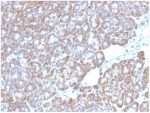 IHC staining of FFPE human pancreatic tissue with LMO2 antibody (clone LMO2/1972). HIER: boil tissue sections in pH 9 10mM Tris with 1mM EDTA for 20 min and allow to cool before testing.