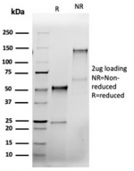 SDS-PAGE analysis of purified, BSA-free recombinant BCL2L1 antibody (clone rBCL2L1/4508) as confirmation of integrity and purity.