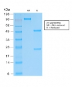 SDS-PAGE analysis of purified, BSA-free recombinant SOX9 antibody (SOX9/2287R) as confirmation of integrity and purity.