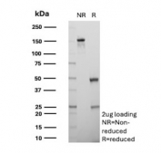 SDS-PAGE analysis of purified, BSA-free BPIFB1 antibody (clone LPLUNC1/3206) as confirmation of integrity and purity.