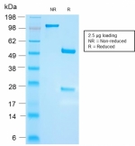 SDS-PAGE analysis of purified, BSA-free recombinant FSH beta antibody (clone FSHb/2033R) as confirmation of integrity and purity.