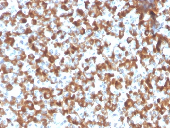 IHC staining of FFPE human pituitary tissue with recombinant FSH beta antibody (clone FSHb/2033R). HIER: boil tissue sections in pH 9 10mM Tris with 1mM EDTA for 20 min and allow to cool before testing.~