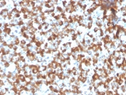 IHC staining of FFPE human pituitary tissue with recombinant FSH beta antibody (clone FSHb/2033R). HIER: boil tissue sections in pH 9 10mM Tris with 1mM EDTA for 20 min and allow to cool before testing.