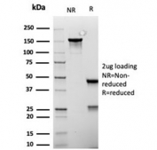SDS-PAGE analysis of purified, BSA-free recombinant MSH6 antibody (clone rMSH6/6846) as confirmation of integrity and purity.