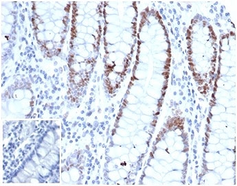 IHC staining of FFPE human small intestine tissue with recombinant MSH6 antibody (clone rMSH6/6846). HIER: boil tissue sections in pH 9 10mM Tris with 1mM EDTA for 20 min and allow to cool before testing.~