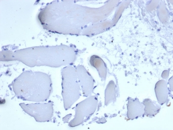 Negative control: IHC staining of FFPE human skeletal muscle with recombinant Mammaglobin A antibody (rMGB/6619) at 2ug/ml in PBS for 30min RT. HIER: boil tissue sections in pH 9 10mM Tris with 1mM EDTA for 20 min and allow to cool before testing.