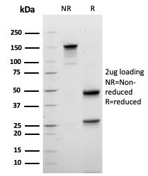 SDS-PAGE analysis of purified, BSA-free recombinant Mammaglobin A antibody (clone rMGB/6619) as confirmation of integrity and purity.