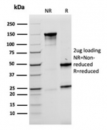 SDS-PAGE analysis of purified, BSA-free recombinant LMO2 antibody (clone rLMO2/1971) as confirmation of integrity and purity.