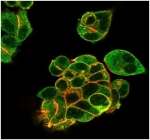 Immunofluorescent staining of PFA-fixed human MCF-7 cells using Lactoferrin antibody (green, clone LTF/4082) and phalloidin (red).