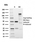 SDS-PAGE analysis of purified, BSA-free recombinant Rhombotin 2 antibody (LMO2/3147R) as confirmation of integrity and purity.
