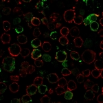 Immunofluorescent staining of human K562 cells using recombinant Rhombotin 2 antibody (green, clone LMO2/3147R) and phalloidin (red).