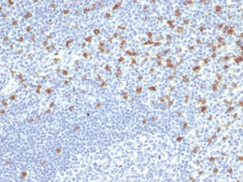 IHC staining of FFPE human tonsil tissue with recombinant CD8A antibody (clone rCD8/6590). HIER: boil tissue sections in pH 9 10mM Tris with 1mM EDTA for 20 min and allow to cool before testing.