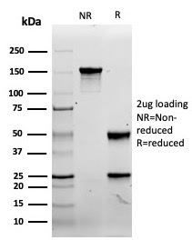 SDS-PAGE analysis of purified, BSA-free recombinant CD8A antibody (rCD8/6590) as confirmation of integrity and purity.