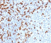 IHC staining of FFPE human tonsil tissue with recombinant CD7 antibody (clone rCD7/6387). HIER: boil tissue sections in pH 9 10mM Tris with 1mM EDTA for 20 min and allow to cool before testing.