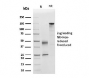 SDS-PAGE analysis of purified, BSA-free APOD antibody (clone APOD/3415) as confirmation of integrity and purity.