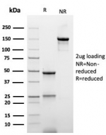 SDS-PAGE analysis of purified, BSA-free recombinant His Tag antibody (clone r6HIS/6423) as confirmation of integrity and purity.