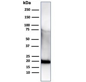 Western blot testing of a His-tagged protein using recombinant His Tag antibody (clone r6HIS/6423).~