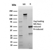 SDS-PAGE analysis of purified, BSA-free recombinant Napsin A antibody (clone rNAPSA/6926) as confirmation of integrity and purity.
