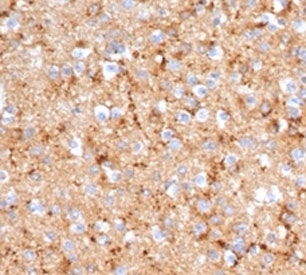 IHC staining of FFPE human brain tissue with recombinant SYP antibody (clone rSYP/6856). HIER: boil tissue sections in pH 9 10mM Tris with 1mM EDTA for 20 min and allow to cool before testing.~