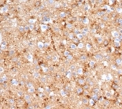 IHC staining of FFPE human brain tissue with recombinant SYP antibody (clone rSYP/6856). HIER: boil tissue sections in pH 9 10mM Tris with 1mM EDTA for 20 min and allow to cool before testing.