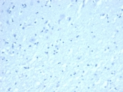 Negative control: IHC staining of FFPE human brain tissue using recombinant INHA antibody (clone INHA/6598R) at 2ug/ml in PBS for 30min RT. HIER: boil tissue sections in pH 9 10mM Tris with 1mM EDTA for 20 min and allow to cool before testing.